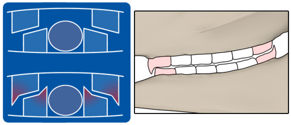 Scharfe Kanten: Das häufigste Zahnproblem im Pferdemaul